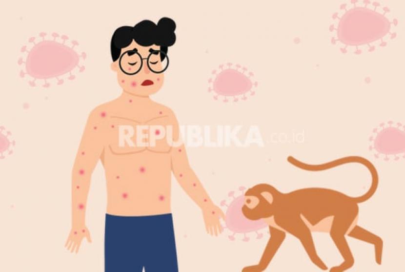 Kemenkes Datangkan 1.000 Dosis Vaksin Mpox, Sisa 40 untuk Dikirim ke Bali